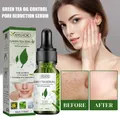 Green Tea Facial Repair Serum Soothing Oil Control Pore Shrink Face Serum Whitening Remove Dark