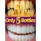 Dental Calculus Remover Cleaning Plaque Tooth Stain Teeth Whitening Products