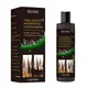 Anti-dandruff Shampoo Nourishing Effective Improve Hair Dandruff E0BD