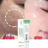 La crema restringente dei pori dell'acido salicilico stringe il prodotto per la cura coreano della