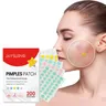 200 Patches Acnes Pimple Patches for Zits and Blemishes Spots Treatments Stickers for Face and Skin