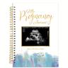 82pages Pregnancy Journal Memory Book, Pregnancy Book For Gift, For New Moms, Pregnancy Announcements With Sonogram Photo, Mom Book Diary, Through Third Trimester Milestone