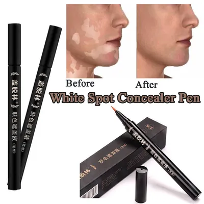 Vitiligo Scars Birthmarks Cover Pen Professional White Spots Tattoo Concealer Herbal Plant Essence