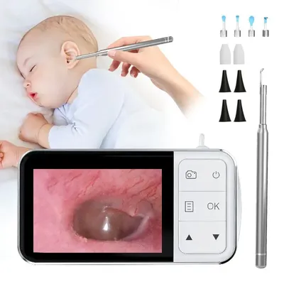 4.5 Inch LCD Digital Otoscope 3.91080P Ear Scope Camera with 6 Lights Ear Wax Removal Tool for Kids