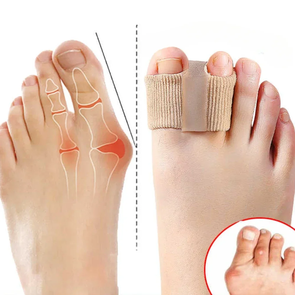 2/1PCS Zehenspreizer Hallux Valgus Bunion Corrector Orthesen Füße Knochen Daumen Teller Korrektur Pediküre Füße Haarglätter Image