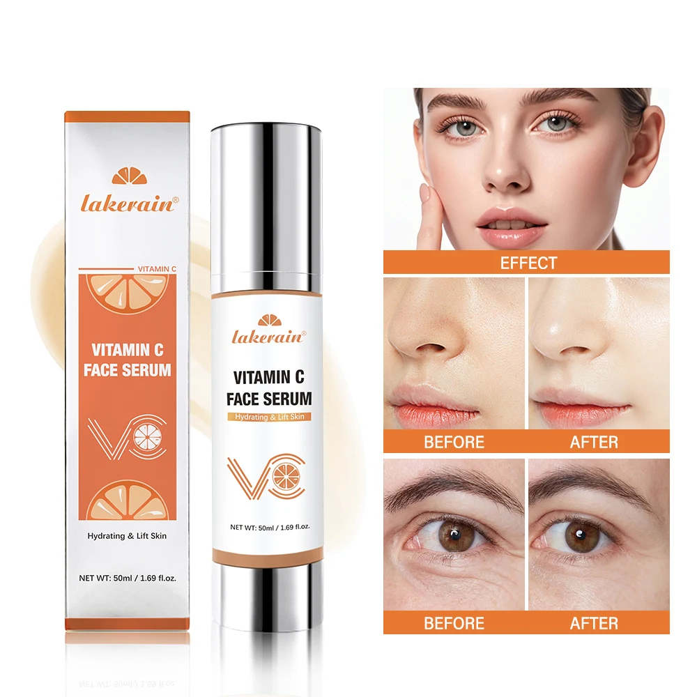 Super Vitamin C Serum Gesicht spendet Feuchtigkeit Faltenreduzierung Dunkle Fleckenentferner Gesichtspflege Hyaluronsäure Serum Ziele Altersflecken Image