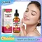 Organic Rosehip Oil Antioxidant Improve Fine Lines Wrinkles Firming Lifting Repair Moisturizer