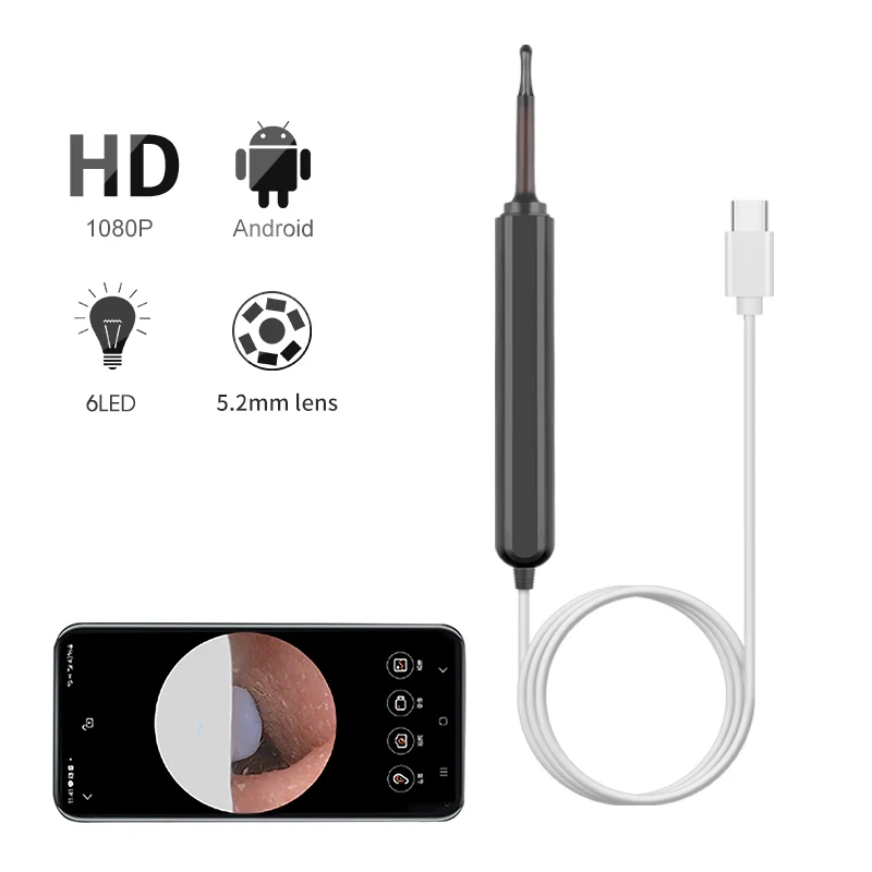Smart Visual Ohr reiniger HD Ohr stöpsel Otoskop USB C Aufladen Endoskop Wachs entfernungs werkzeug Mini-Kamera für Android PC Image