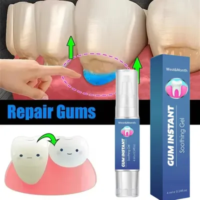 Damaged Gum Repair Care Gel Relieve Sore Gums Allergy Deep Cleaning Teeth Stains Tartar Serum Dental Caries Toothpaste