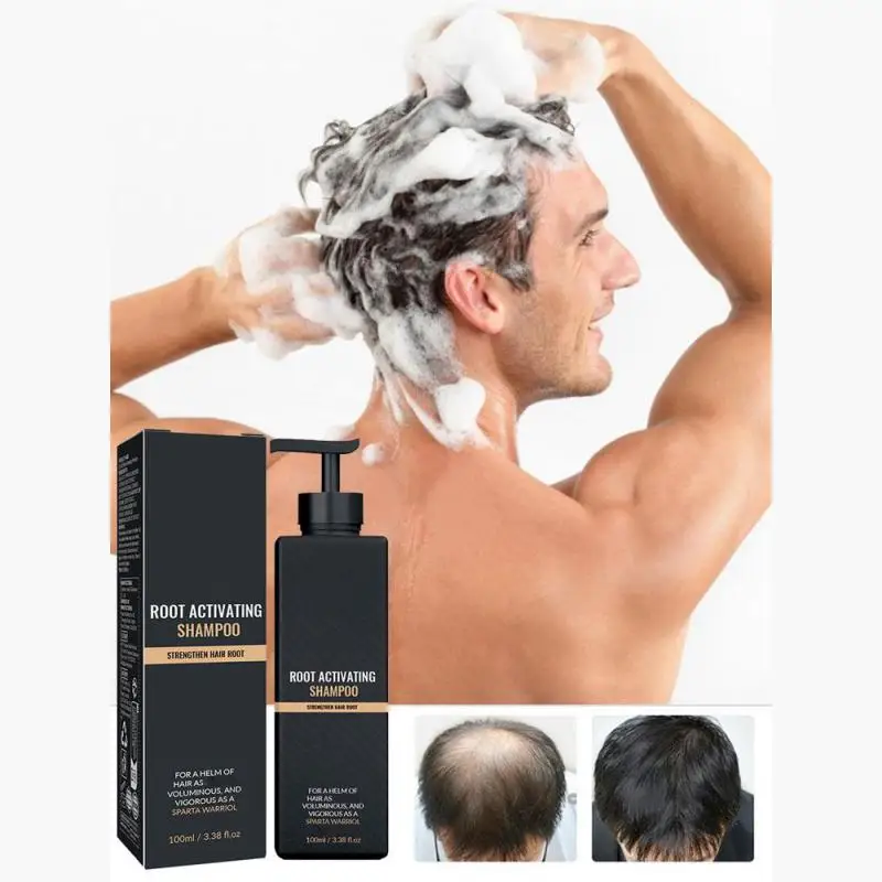 100 ml dichtes Haar-Shampoo, wurzelaktivierendes Shampoo, Manche, stärkendes, aktivierendes Shampoo, stellt Weichheit wieder her, starke Haarspülung Image