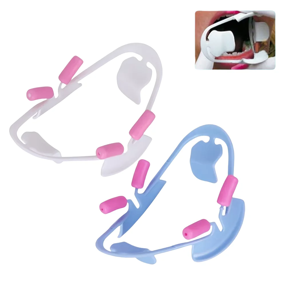 3D-Zahn-Mundöffner – kieferorthopädischer Lippen- und Wangenretraktor für professionelle Zahnaufhellung und Zahnprozessinnen Image