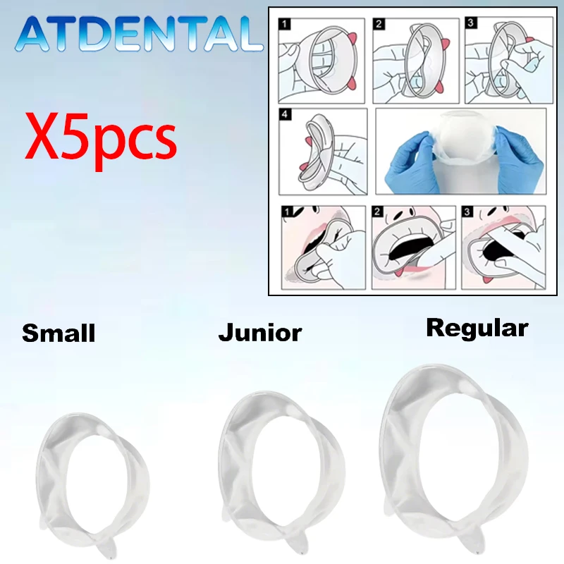 5 Stück Zahnärztlicher Wangenhalter, 3D O-Ring Mundöffner für Oraluntersuchungen, Zahnärztlicher Gummi-Lippenexpander Image