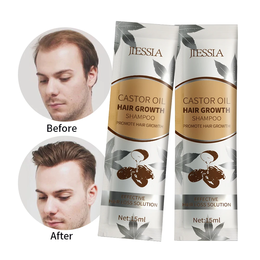 Set Shampoo e Balsamo per la Crescita dei Capelli con Etichetta Privata 100% Naturale con Cipolla Rosmarino Cheratina Argan Collagene e Biotina