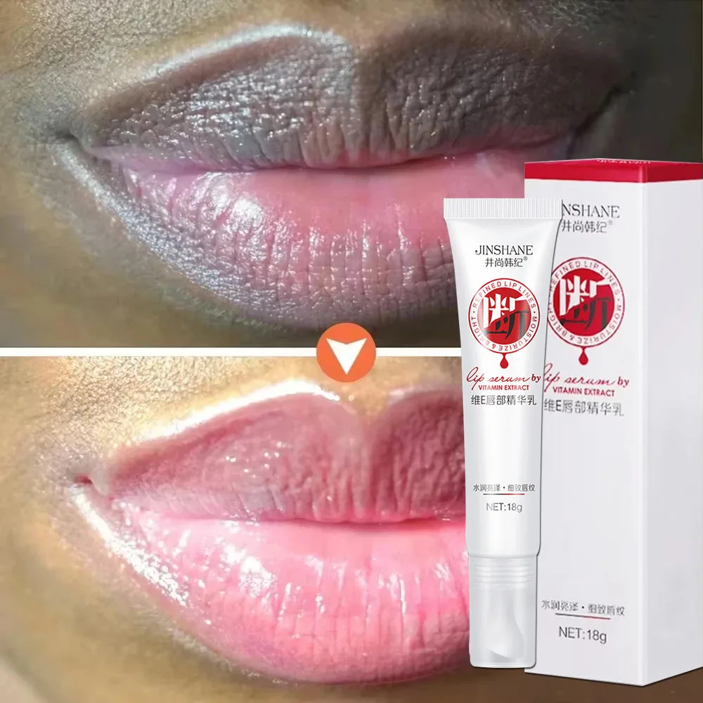 Aufhellende Vitamin-E-Creme zur Entfernung dunkler Lippenflecken, Peeling-Lippenbalsam, Tiefenreinigung, Feuchtigkeitspflege, Nährende Schönheits- und Gesundheitspflege Image