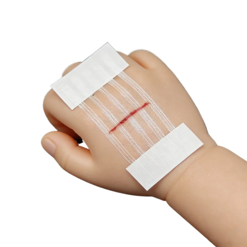 5 Streifen Wundverschlussstreifen Postpartale Wundheilung Kosmetische Chirurgie-Klebestreifen Medizinisches Nahtfreies Chirurgisches Klebeband Image