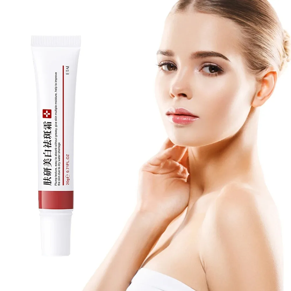 Effektive Sommersprossen creme schnell aufhellen Gesicht entfernen Melasma dunklen Fleck verblassen Melanin weiß Anti-Pigmentierung verbessern Mattheit Image