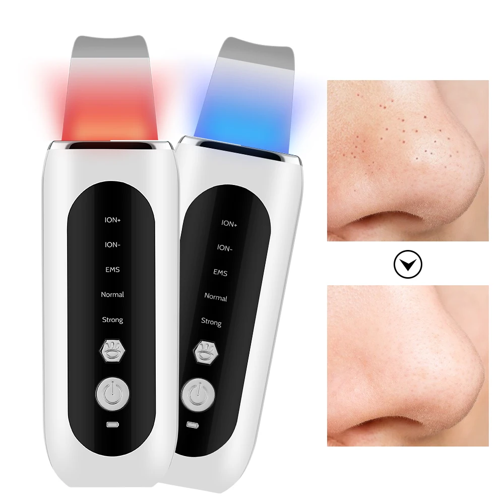 Ultraschall Mitesser Entferner Haut Wäscher Peeling Tiefe Gesicht Reinigung Ultraschall Ionen Ance Poren Reiniger Gesichts Schaufel Reiniger Image